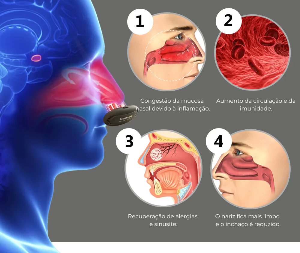 Dispositivo Terapia Nasal de Luz Vermelha RespiRelief™ - Image 5