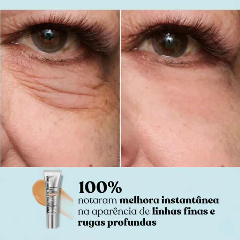 Eye Tightener - Efeito Lifting Instantâneo - Image 3