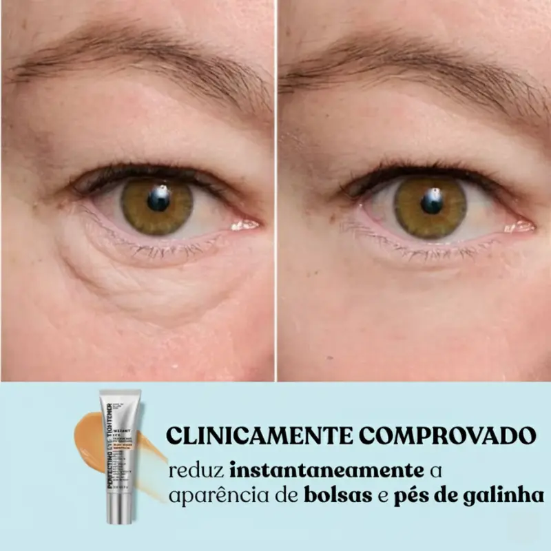Eye Tightener - Efeito Lifting Instantâneo - Image 4