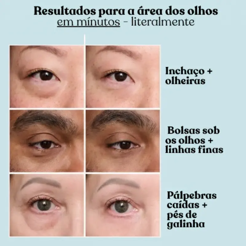 Eye Tightener - Efeito Lifting Instantâneo - Image 5